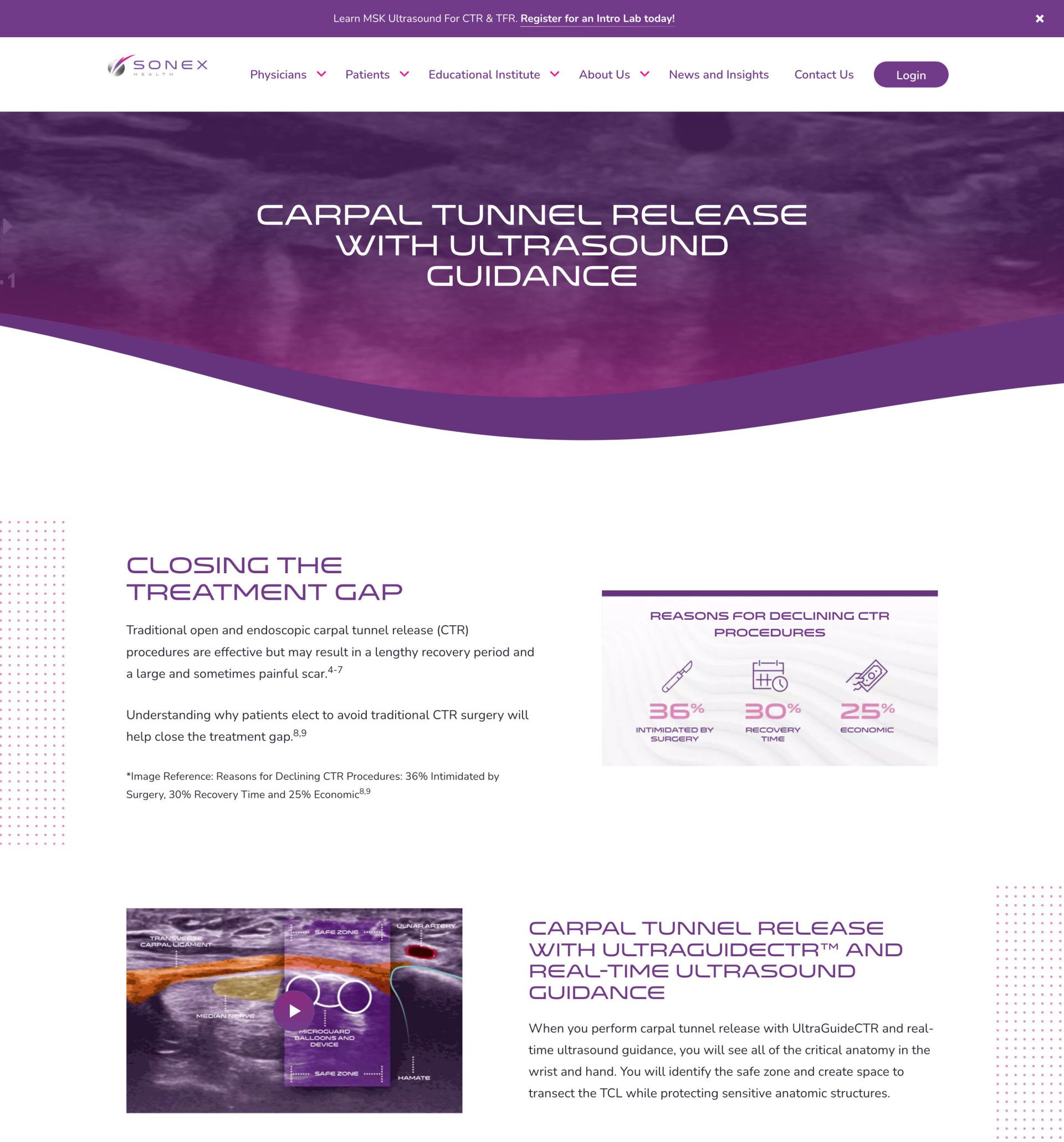 BGO SONEX – Ultrasound-Guided Carpal Tunnel Release Treatment