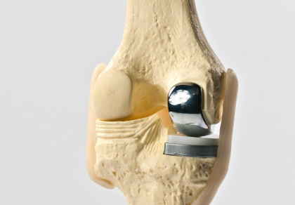 BGO Oxford Cementless Knee Replacement