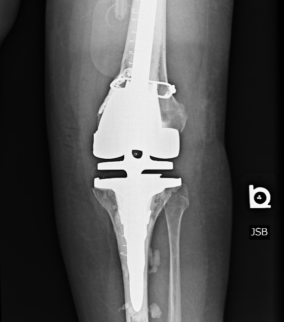 BGO Champion:  Kelly Fitch