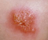 The Importance of Good Hygiene