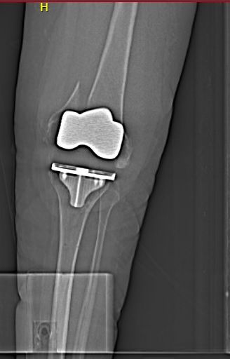 BGO Champion: Kelly Fitch